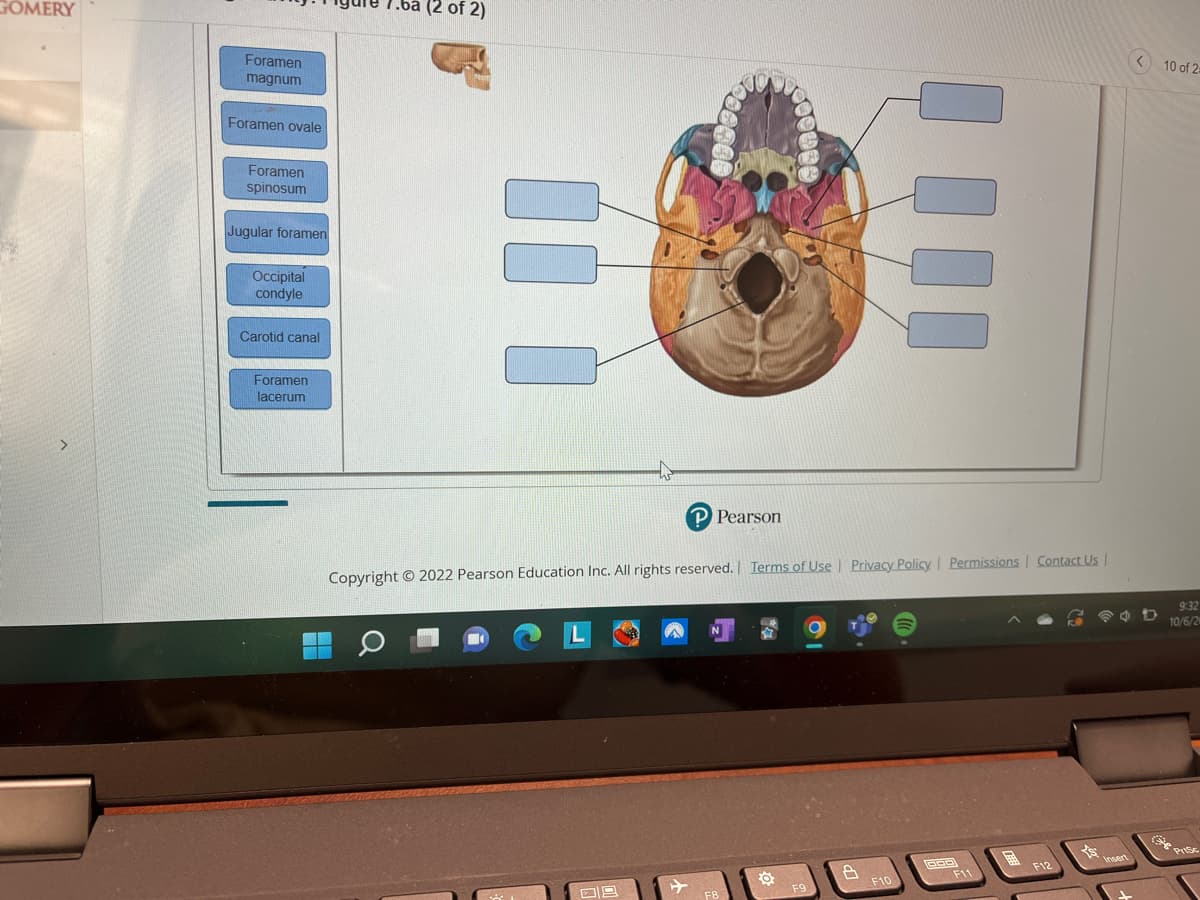 GOMERY
Foramen
magnum
Foramen ovale
Foramen
spinosum
Jugular foramen
Occipital
condyle
Carotid canal
Foramen
lacerum
(2 of 2
P Pearson
Copyright © 2022 Pearson Education Inc. All rights reserved. | Terms of Use | Privacy Policy | Permissions | Contact Us |
O
F9
A
F10
BOD
F11
F12
<10 of 2=
9:32
10/6/20