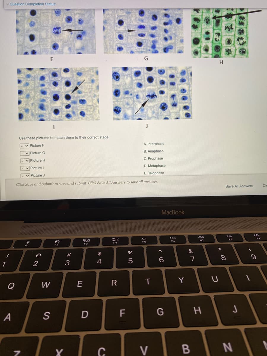 * Question Completion Status:
F
G
Use these pictures to match them to their correct stage.
A. Interphase
v Picture F
B. Anaphase
v Picture G
v Picture H
C. Prophase
D. Metaphase
v Picture I
E. Telophase
- v Picture J
Click Save and Submit to save and submit. Click Save All Answers to save all answers.
Clo
Save All Answers
MacBook
DII
FB
F7
F5
F3
F4
F2
F1
*
&
#
$
6.
7
8.
1
2
3
4
W
E
R
Y
Q
D
F
G
J
A
S
C
V
