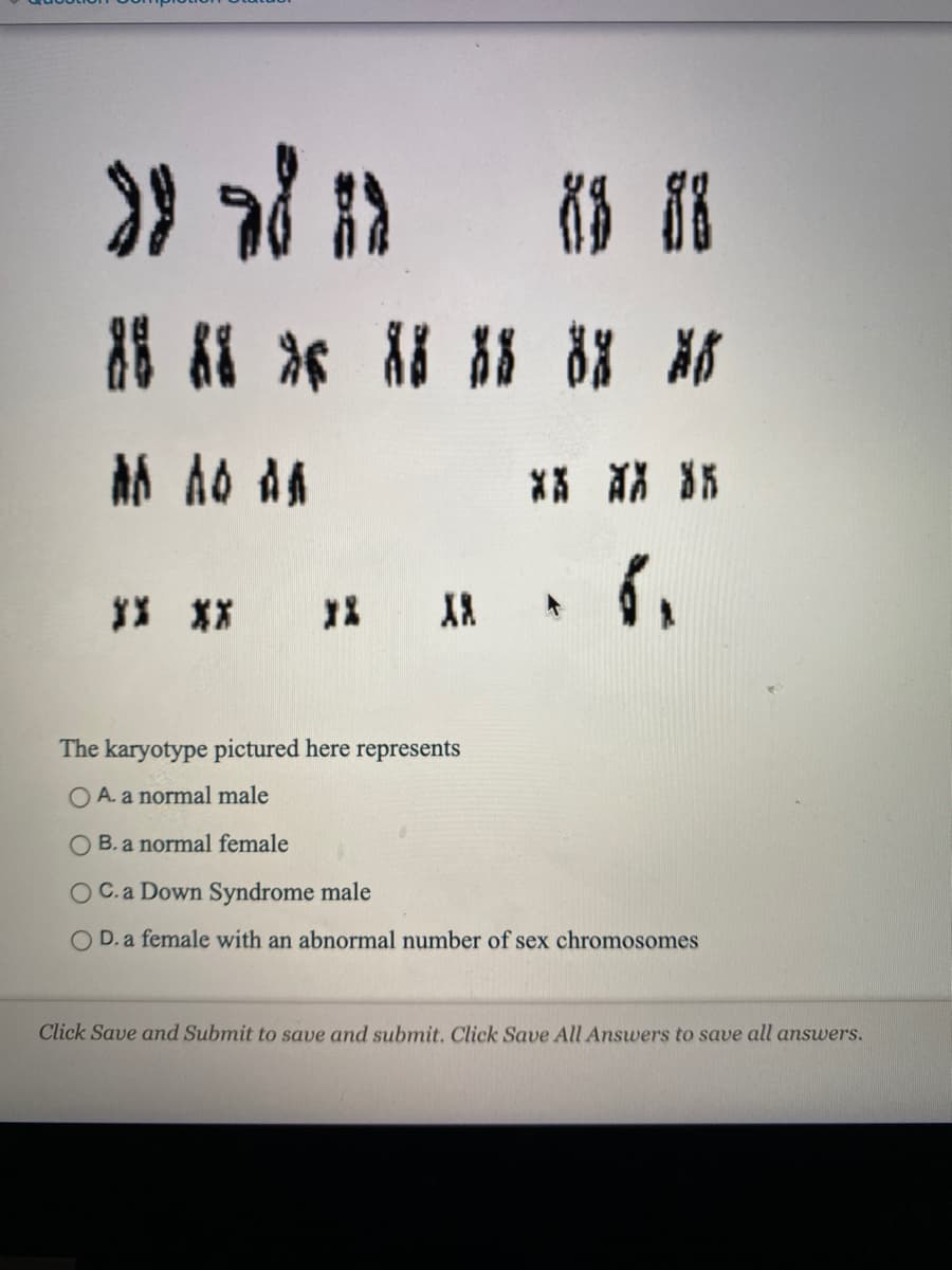 ** ** %5
X **
The karyotype pictured here represents
O A. a normal male
O B. a normal female
OC.a Down Syndrome male
D. a female with an abnormal number of sex chromosomes
Click Save and Submit to save and submit. Click Save All Answers to save all answers.
