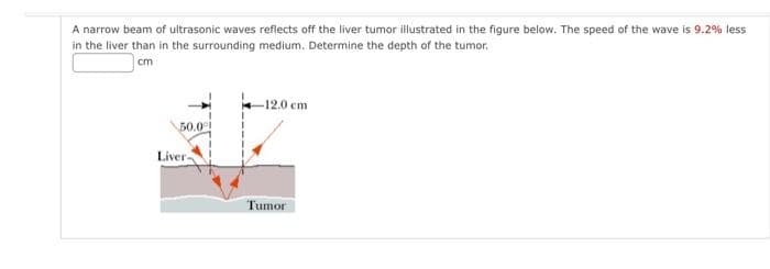 A narrow beam of ultrasonic waves reflects off the liver tumor illustrated in the figure below. The speed of the wave is 9.2% less
in the liver than in the surrounding medium. Determine the depth of the tumor.
cm
50.0
Liver-
-12.0 cm
Tumor