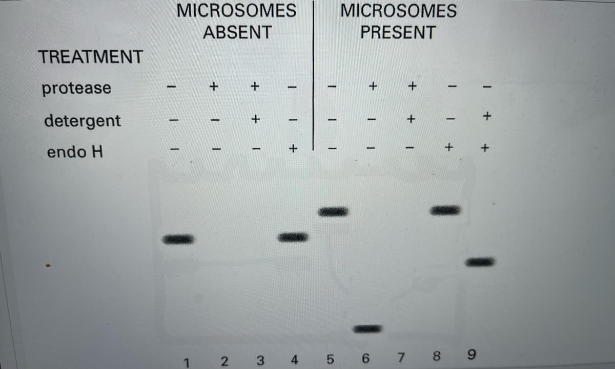 MICROSOMES
MICROSOMES
ABSENT
PRESENT
TREATMENT
protease
+
detergent
endo H
1
2 3 4 5 6 7 8
