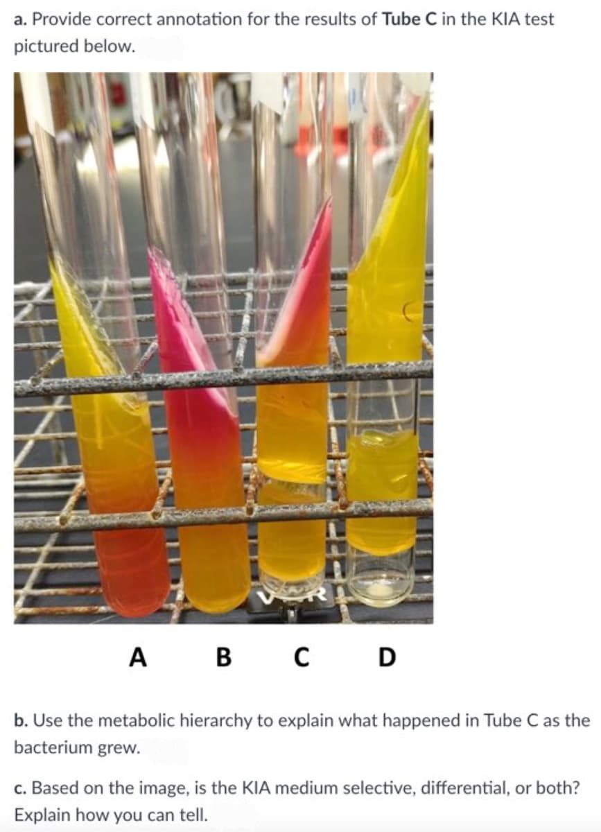 a. Provide correct annotation for the results of Tube C in the KIA test
pictured below.
A B C D
b. Use the metabolic hierarchy to explain what happened in Tube C as the
bacterium grew.
c. Based on the image, is the KIA medium selective, differential, or both?
Explain how you can tell.