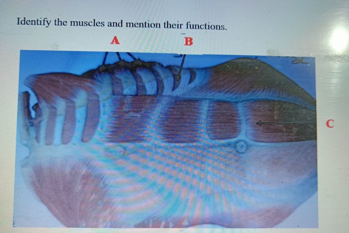 Identify the muscles and mention their functions.
A
B
C