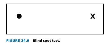 FIGURE 24.9 Blind spot test.
