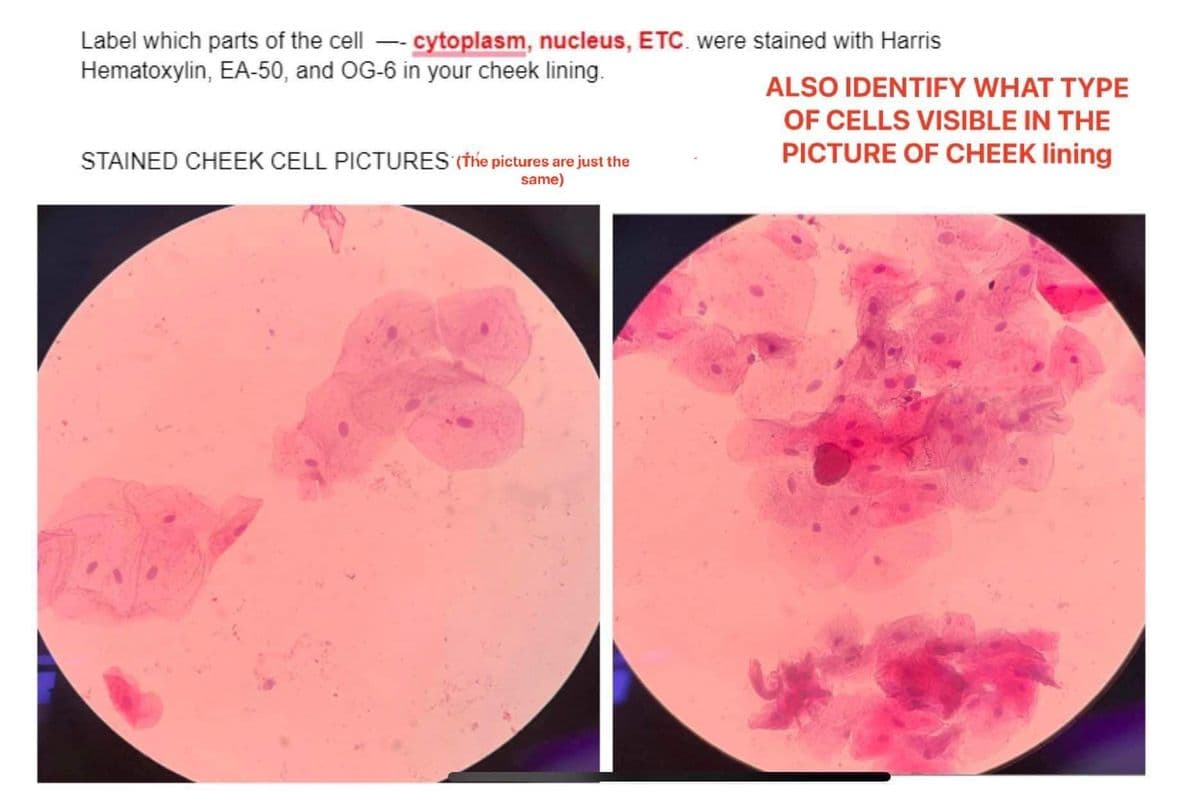 Label which parts of the cell - cytoplasm, nucleus, ETC. were stained with Harris
Hematoxylin, EA-50, and OG-6 in your cheek lining.
ALSO IDENTIFY WHAT TYPE
OF CELLS VISIBLE IN THE
STAINED CHEEK CELL PICTURES (the pictures are just the
PICTURE OF CHEEK lining
same)
