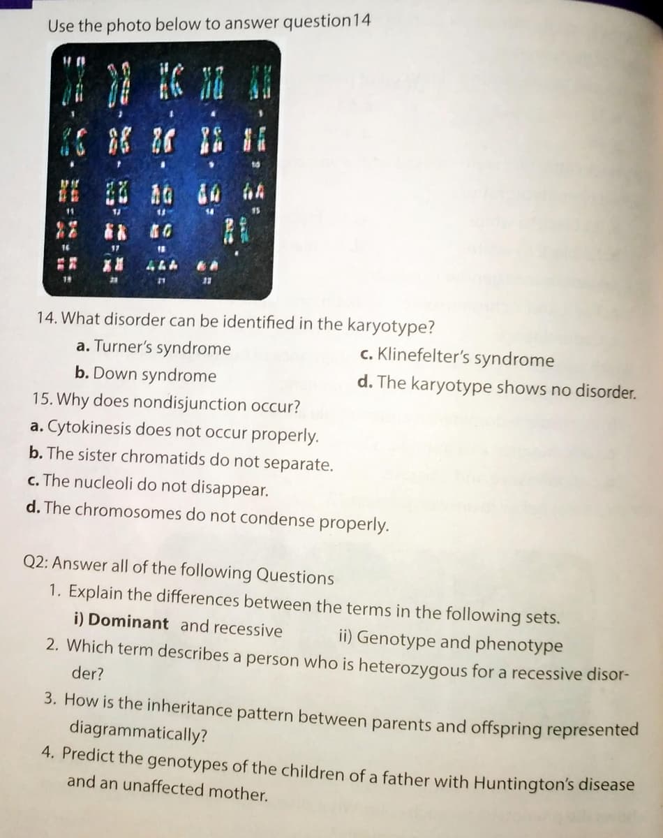 Use the photo below to answer question 14
11
16
17
18
444
13
14. What disorder can be identified in the karyotype?
c. Klinefelter's syndrome
a. Turner's syndrome
b. Down syndrome
d. The karyotype shows no disorder.
15. Why does nondisjunction occur?
a. Cytokinesis does not occur properly.
b. The sister chromatids do not separate.
c. The nucleoli do not disappear.
d. The chromosomes do not condense properly.
Q2: Answer all of the following Questions
1. Explain the differences between the terms in the following sets.
i) Dominant and recessive
ii) Genotype and phenotype
2. Which term describes a person who is heterozygous for a recessive disor-
der?
3. How is the inheritance pattern between parents and offspring represented
diagrammatically?
4. Predict the genotypes of the children of a father with Huntington's disease
and an unaffected mother.
