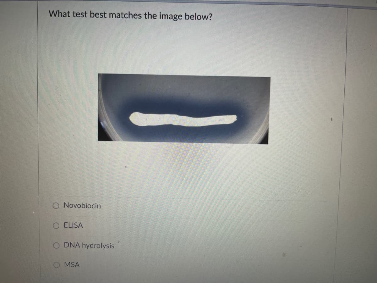 What test best matches the image below?
O Novobiocin
O ELISA
DNA hydrolysis
O MSA
