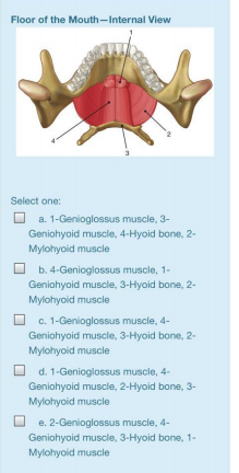 Floor of the Mouth-Internal View
Select one:
a. 1-Genioglossus muscle, 3-
Geniohyoid muscle, 4-Hyoid bone, 2-
Mylohyoid muscle
b. 4-Genioglossus muscle, 1-
Geniohyoid muscle, 3-Hyoid bone, 2-
Mylohyoid muscle
O c. 1-Genioglossus muscle, 4-
Geniohyoid muscle, 3-Hyoid bone, 2-
Mylohyoid muscle
O d. 1-Genioglossus muscle, 4-
Geniohyoid muscle, 2-Hyoid bone, 3-
Mylohyoid muscle
e. 2-Genioglossus muscle, 4-
Geniohyoid muscle, 3-Hyoid bone, 1-
Mylohyoid muscle
