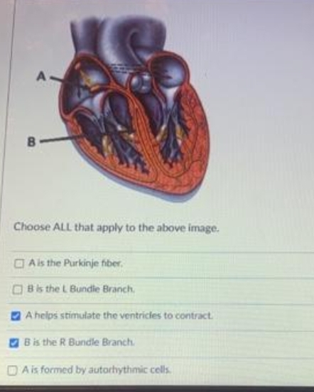 Choose ALL that apply to the above image.
O Ais the Purkinje fiber.
O Bis the L Bundile Branch.
A helps stimulate the ventricles to contract.
Bis the R Bundle Branch.
D A is formed by autorhythmic cells.
