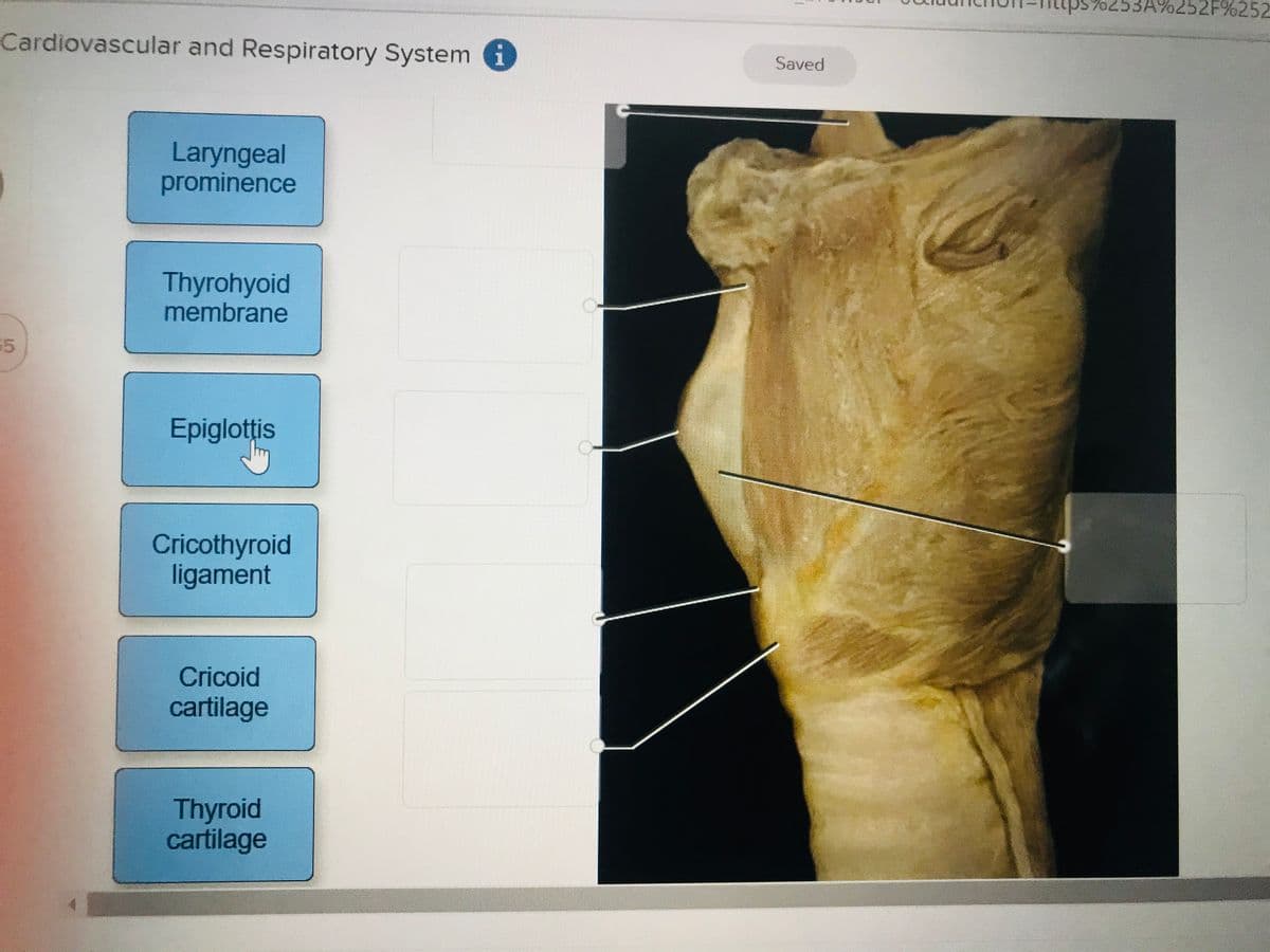 52F%252
Cardiovascular and Respiratory System i
Saved
Laryngeal
prominence
Thyrohyoid
membrane
55
Epiglottis
Cricothyroid
ligament
Cricoid
cartilage
Thyroid
cartilage
