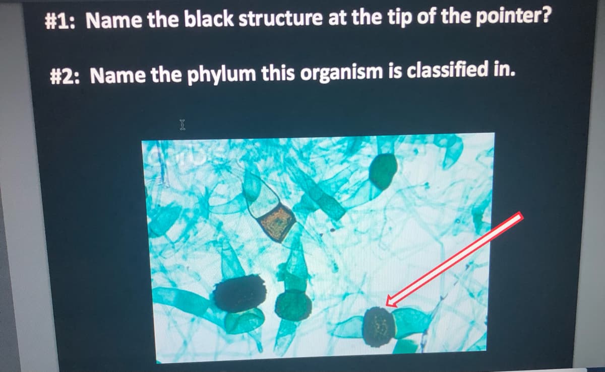 #1: Name the black structure at the tip of the pointer?
# 2: Name the phylum this organism is classified in.
