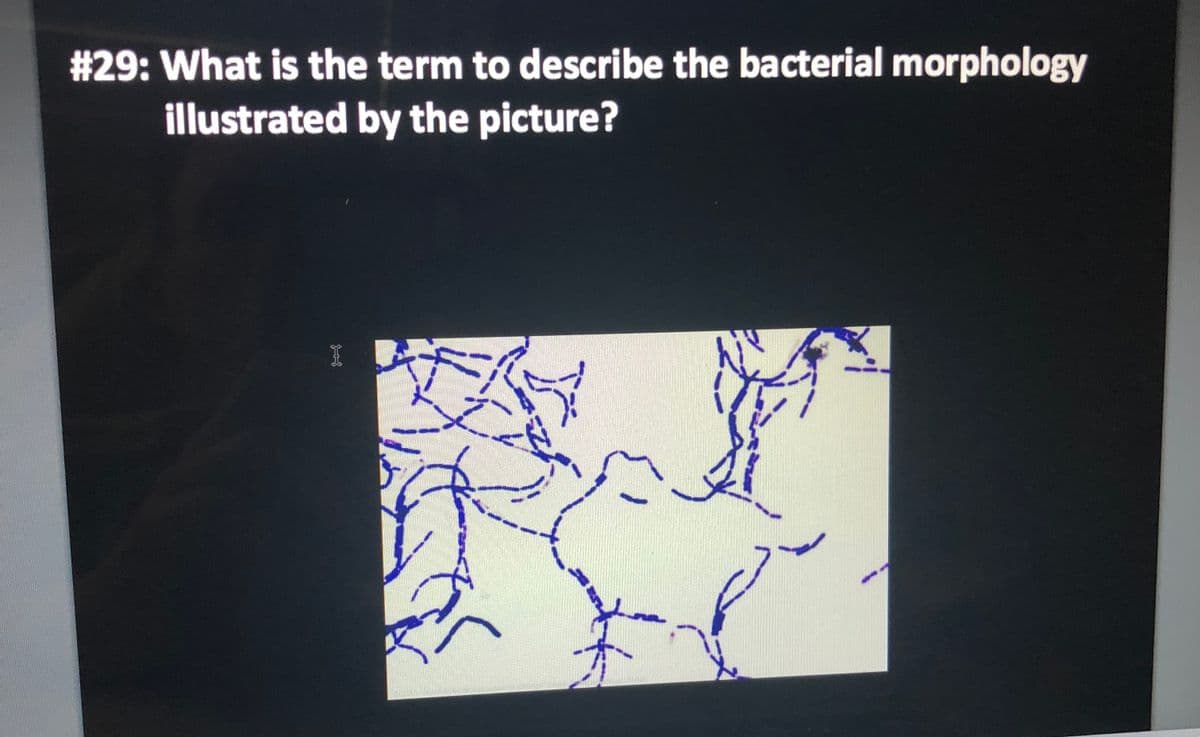 # 29: What is the term to describe the bacterial morphology
illustrated by the picture?
