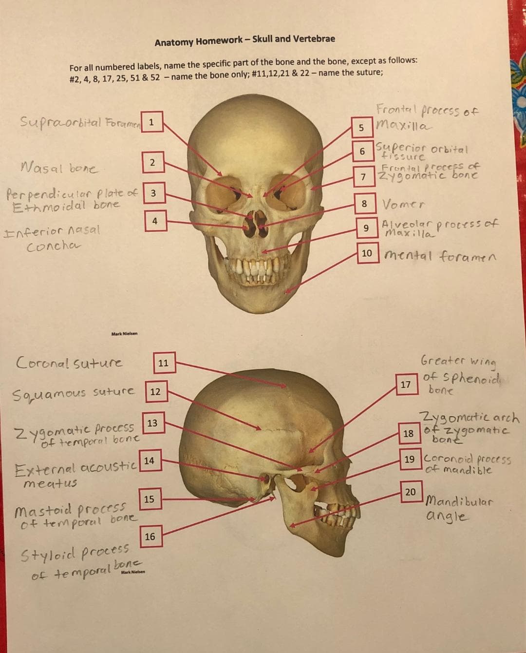 Anatomy Homework - Skull and Vertebrae
For all numbered labels, name the specific part of the bone and the bone, except as follows:
# 2, 4, 8, 17, 25, 51 & 52 -name the bone only; #11,12,21 & 22 - name the suture;
Supraorbital Foramen 1
Fronteal process of
maxilla
Superior orbital
fissurc
6.
Wasal bone
Frontal Process of
7 Zygomaátic bone
Perpendicularplate of
Ethmo idal bone
8 Vomer
Alveolar process of
4
Inferior nasal
Concha
9
Maxilla
10 mental foramen
Mark Nielsen
Greater wing
of sphenoid
bone
Coronal suture
11
17
12
Squamous suture
Zygomatic arch
Zygomatic process
temporal bone
13
18 of zygomatic
bont
External acoustic 14
meatus
19 Coronoid process
of mandible
20
Mandibular
15
Mastoid process
angle
of temporal bone
16
Styloid procesS
of temporal bone
Mark Nielsen
