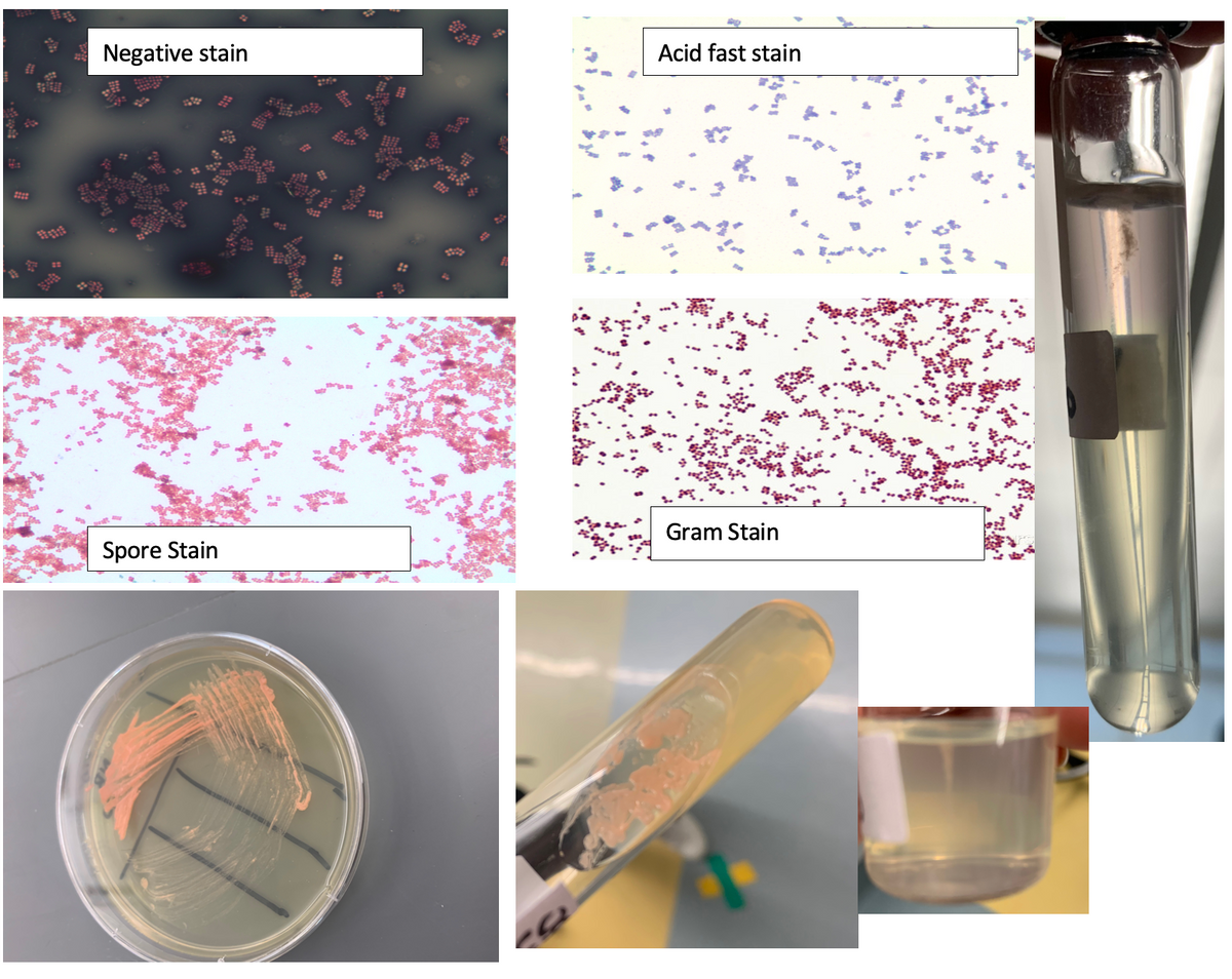 Negative stain
Acid fast stain
2
Gram Stain
Spore Stain
