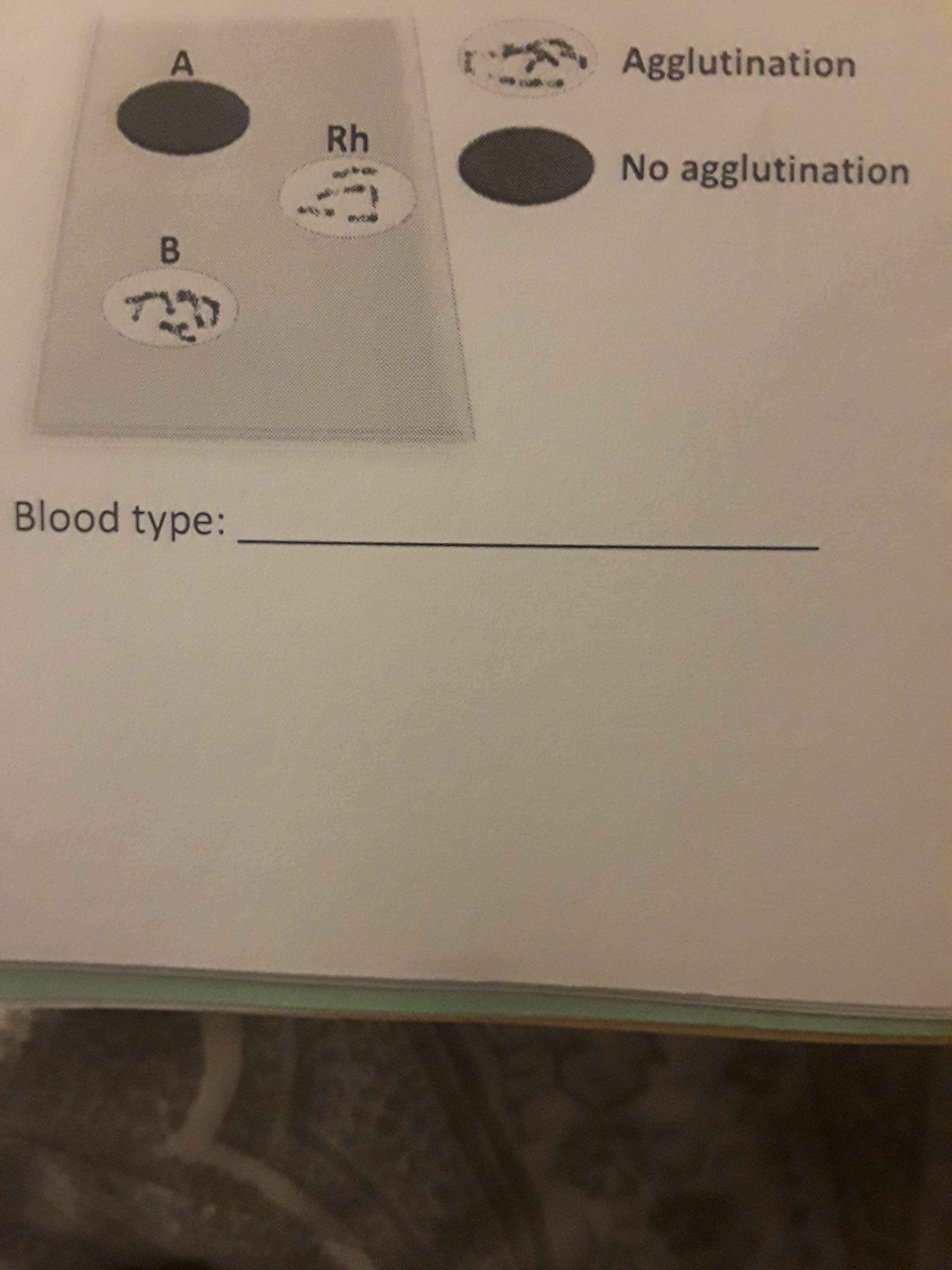 Agglutination
8b
Rh
No agglutination
Blood type:
