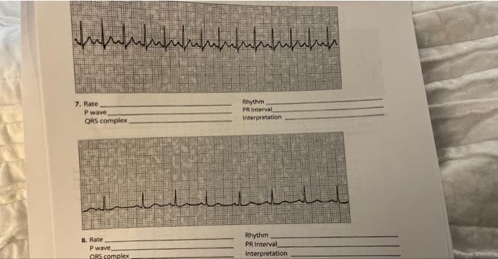 Infufufufu/n/mm/n/nufnfula
7. Rate
P wave,
QRS complex
8. Rate
السلب
P wave
ORS complex
Rhythm
PR Interval,
Interpretation
Rhythm
PR Interval
Interpretation