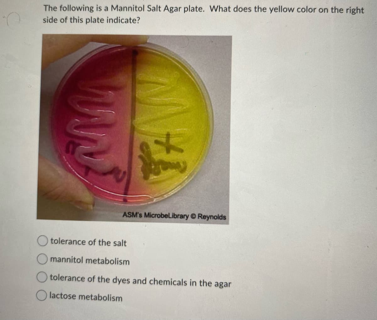 The following is a Mannitol Salt Agar plate. What does the yellow color on the right
side of this plate indicate?
TAW
ASM's MicrobeLibrary Ⓒ Reynolds
tolerance of the salt
mannitol metabolism
tolerance of the dyes and chemicals in the agar
lactose metabolism