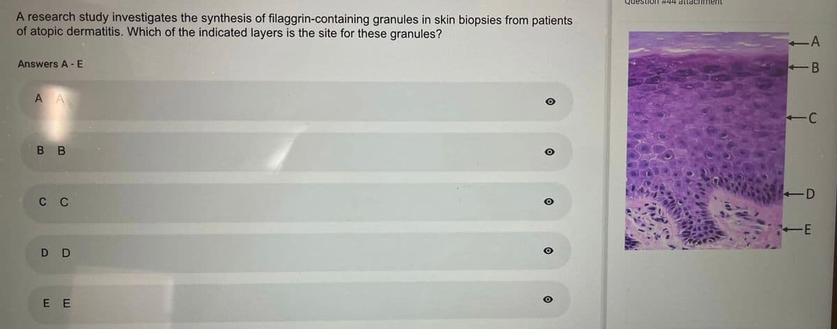 A research study investigates the synthesis of filaggrin-containing granules in skin biopsies from patients
of atopic dermatitis. Which of the indicated layers is the site for these granules?
Answers A - E
AA
B B
C C
D D
EE
O
O
O
Question #44 attachment
<-A
B
-C
-D
E