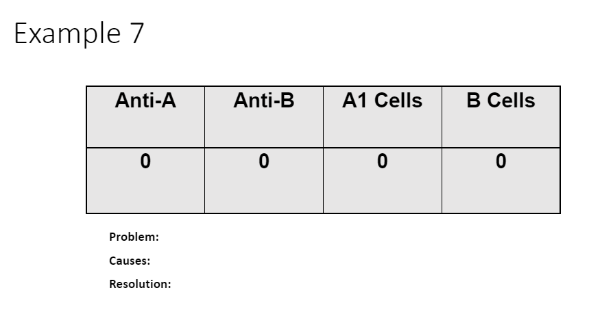 Example 7
Anti-A
0
Problem:
Causes:
Resolution:
Anti-B
0
A1 Cells
0
B Cells
0