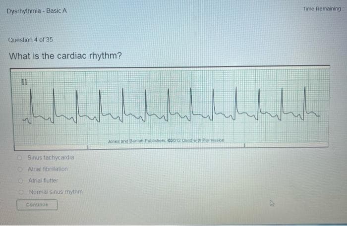 Dysrhythmia - Basic A
Question 4 of 35
What is the cardiac rhythm?
II
3
wh
Sinus tachycardia
Atrial fibrillation
Atrial flutter
Normal sinus rhythm
Continue
whichit
Time Remaining
whihihih
Jones and Bartlett Publishers, 2012 Used with Permission