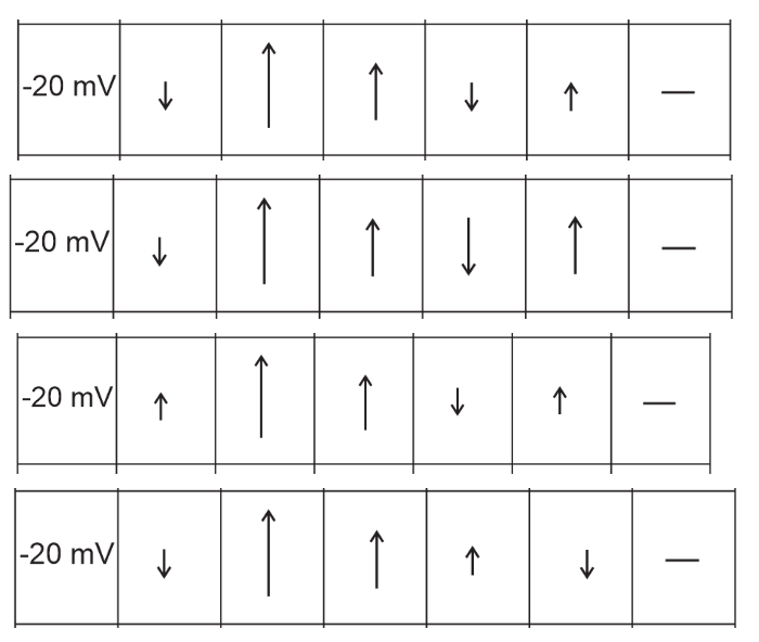 |-20 mV| ↓
|-20 mV|
|-20 mV
|-20 mV|
↓
个
↓
1
↑
1
↑
↓
↑↓
↑
↓
←
↑
个
个
↓
—
T
-