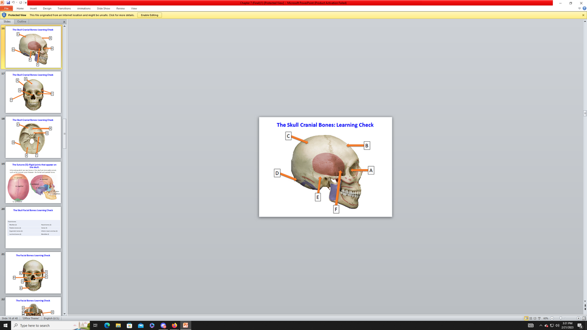 P
Protected View
Slides Outline
16
17
File
18
19
20
21
22
Home
D
The Skull Cranial Bones: Learning Check
a
The Skull Cranial Bones: Learning Check
B
D
A. Coronal
The Skull Cranial Bones: Learning Check
C
B. Sagittal
C. Lambdoid
E
Insert Design Transitions Animations
This file originated from an Internet location and might be unsafe. Click for more details.
B
The Sutures (5): Rigid joints that appear on
the skull.
Aline along which any two bones of the skull are immovably joined,
such as the coronal suture between the frontal and parietal bones
Facial bones
Maxile (2)
Palatine bones (2)
Zygomatic bones (2)
Lacrimal bones (2)
E
Slide 16 of 48
+
C
ame
B
C. Lambdoid
The Skull Facial Bones: Learning Check
m
A. Coronal
B. squamous
The Facial Bones: Learning Check
B
C
"Office Theme"
The Facial Bones: Learning Check
Nasal bones (2)
Vomer
Inferior nasal conchae (2)
Mandible (1)
Dinter
31 maxillary
Type here to search
D
English (U.S.)
Slide Show
Review
View
Enable Editing
Po
Chapter 7 (Final)(1) [Protected View] - Microsoft PowerPoint (Product Activation Failed)
The Skull Cranial Bones: Learning Check
D
с
E
B
A
回铝室 60%
GE
I
(»)
3:31 PM
2/21/2023
x
X
+*