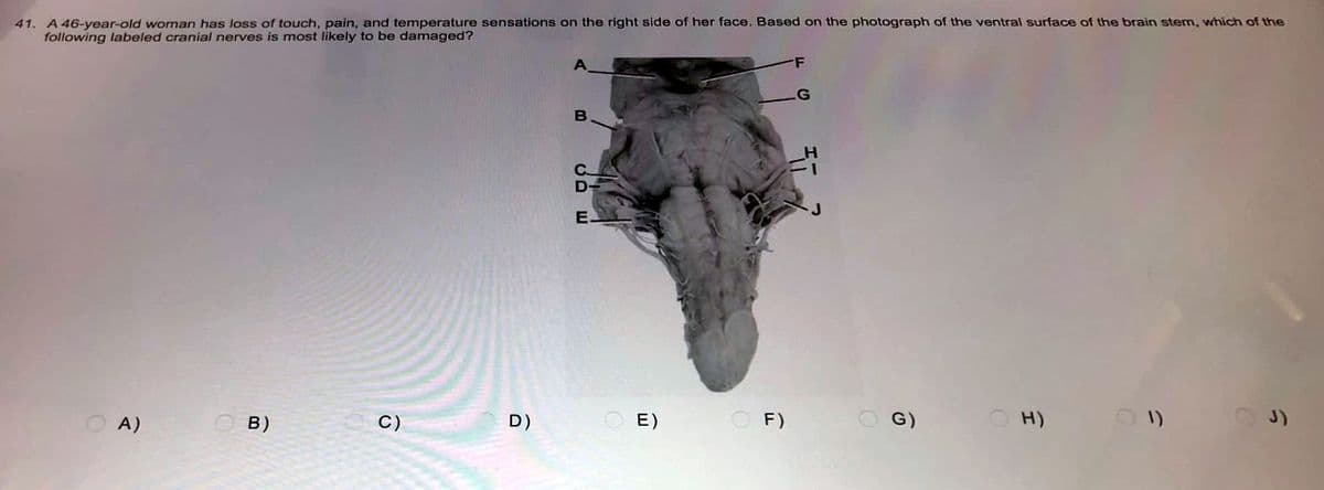 41. A 46-year-old woman has loss of touch, pain, and temperature sensations on the right side of her face. Based on the photograph of the ventral surface of the brain stern, which of the
following labeled cranial nerves is most likely to be damaged?
A
F
G
24
OH)
(1)
OA)
B)
C)
D)
B
C
D-
E.
OE)
OF)
G)